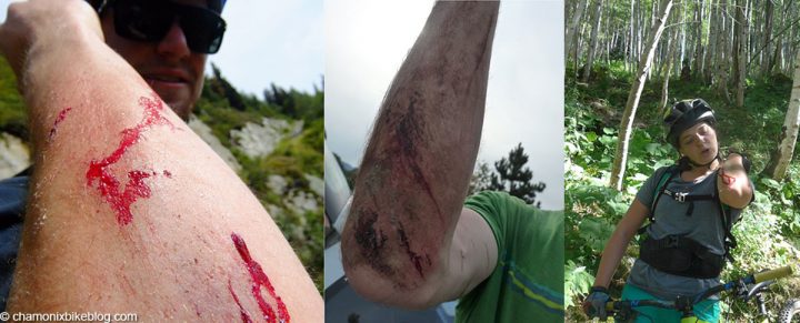 101 things that could have gone better Why is it always the elbow?